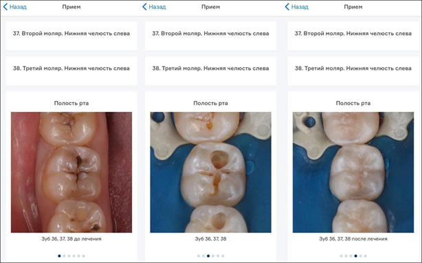 Our patient has access to a card, photographs of interventions, γ-images of teeth and all treatment protocols