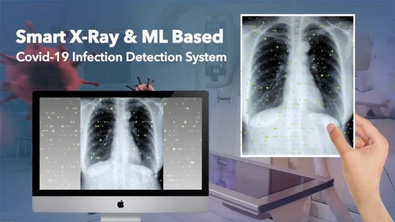 Rapid Covid-19 Detection on X-rays with Raspberry Pi