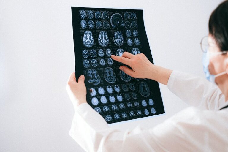 Secrets of the brain.  Analyzing MRI data with FreeSurfer and Python